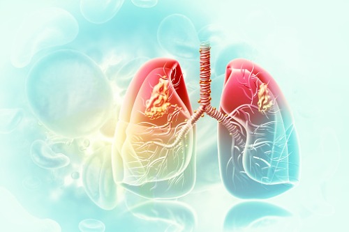 Descubre qué es el asma y como controlar la enfermedad – Adeslas Salud y Bienestar
