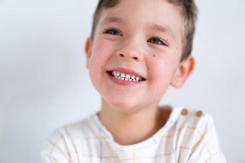 Descubre por qué a algunos niños no se les caen los dientes de leche – Adeslas Salud y Bienestar