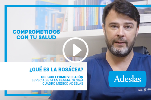 Descubre qué es y cómo tratar la rosácea con nuestro dermatólogo el Dr. Guillermo Villalón - Adeslas Salud y Bienestar